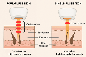 In-depth Analysis: How Dual Pulse Technology Boosts the Efficiency of IPL Hair Removal Devices - SALLOOT