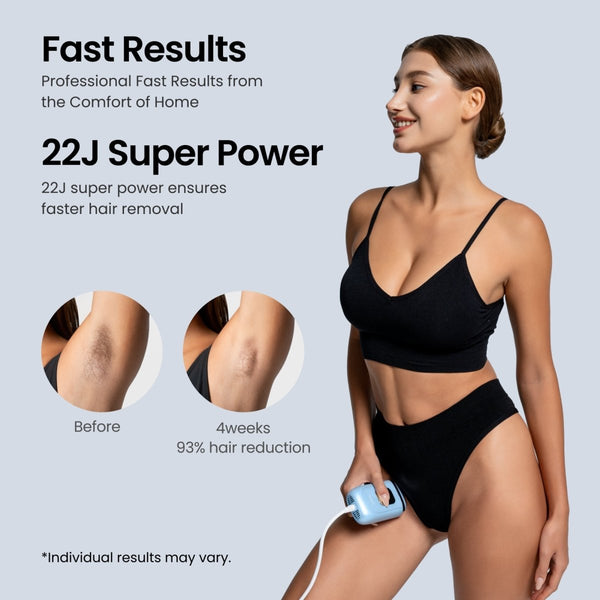 Salloot ipl long-lasting hair removal Nova P5 result