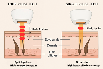 Multiple-Pluses Hair Removal