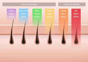 Is IPL Good for Your Skin? Exploring the Benefits of IPL Treatment with a Home IPL Device for Skin Care - SALLOOT
