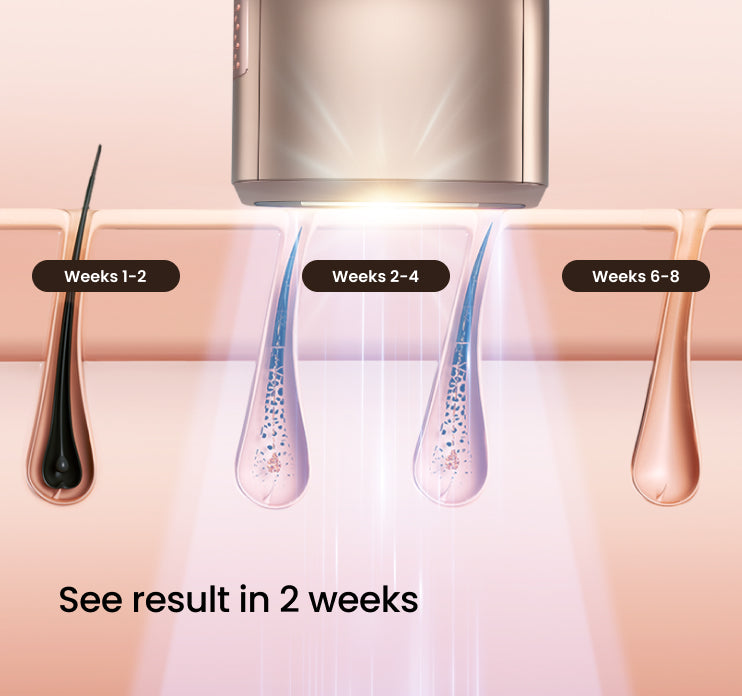 SALLOOT Trinity iGlow 10 Smart AI IPL Hair Removal